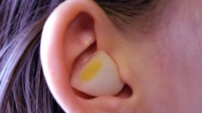manfaat bawang putih untuk telinga